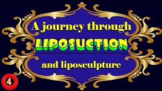 A journey through liposuction and liposculpture Part 410 [upl. by Enilrac]