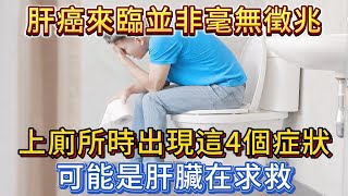 肝癌來臨並非毫無徵兆，上廁所時出現這4個症狀，可能是肝臟在求救！ [upl. by Ahern]