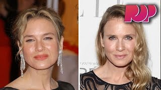 What Happened To Renee Zellweger [upl. by Joette]