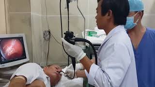 Transnasal Gastroscopy [upl. by Enar]