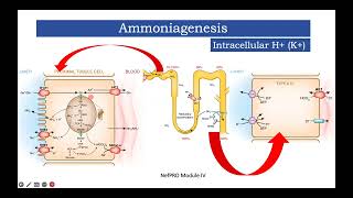 Module IV Approach to Hypokalemic Metabolic Alkalosis [upl. by Llerrom24]