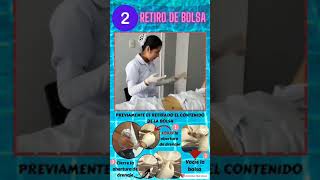 ¿Cómo se cambia una bolsa de colostomía [upl. by Norbel706]