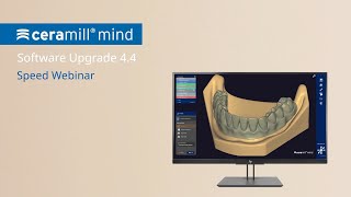 Ceramill Upgrade 44  Speed Webinar English [upl. by Nievelt]