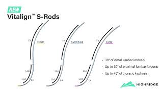 Highridge Medical Vitalign™ SRods [upl. by Ardni]