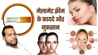 Melamet cream  Melamet cream uses in Hindi  Melamet cream ke fayde  दाग धब्बों के लिए [upl. by Ayocat]