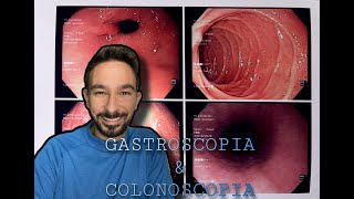 Endoscopia Colonoscopia y Gastroscopia ¡¡Mi experiencia [upl. by Esinehs]