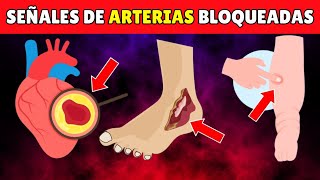 7 Señales de ADVERTENCIA de Arterias del Corazón Bloqueadas en las Piernas y Pies [upl. by Wailoo]