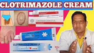 Clotrimazole cream  clotrimazole cream ip  Candid cream for itching Canesten cream [upl. by Datnow435]