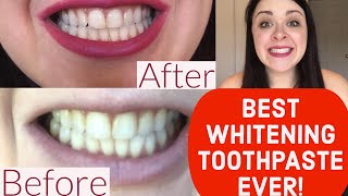 BEST WHITENING TOOTHPASTE EVER REVIEW Crest 3D White Brilliance [upl. by Nosremaj]