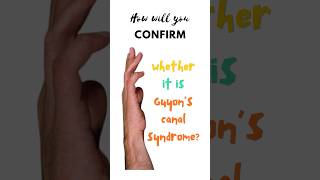 Confirmatory test for Guyon’s canal syndrome Froment’s test Ulnar tunnel syndrome shorts [upl. by Kline]