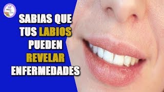 Tus labios pueden revelar enfermedades [upl. by Porta]