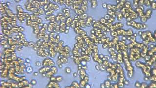 Lidl Bresser Biolux microscope video capture [upl. by Ierbua666]