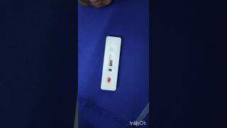 Malaria test in emergency ward emergency duty hospital nursing doctor subscribe mbbs [upl. by Yednarb]