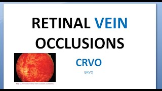 Ophthalmology CRVO Central Retinal Vein Occlusion Splashed tomato Thunder Ischemic RAPD glaucoma [upl. by Eiramaneet]