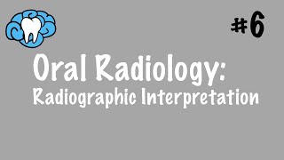 Oral Radiology  Radiographic Interpretation  INBDE ADAT [upl. by Gabrielle]