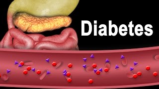 Diabetes Type 1 and Type 2 Animation [upl. by Bartley]