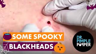 Some Spooky Blackheads [upl. by Shawnee]