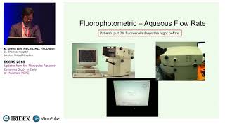 Updates from the MicroPulse Aqueous Dynamics Study in Early or Moderate POAG [upl. by Adlihtam477]