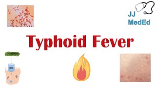 Typhoid Fever Pathogenesis vectors bacteria Symptoms Diagnosis Treatment Vaccine [upl. by Anelliw215]