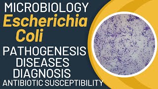 Escherichia coli pathogenesis  E coli microbiology  e coli general properties [upl. by Anselma]