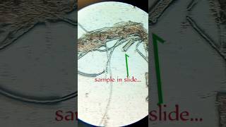 🔬Microscopic view of polysiphonia🧫🧬underthemicroscope MuskanSaraswat [upl. by Stewart]