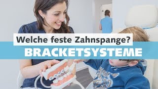 Feste Zahnspange  Bracketsysteme beim Kieferorthopäden  Welche Arten und Vorteile gibt es [upl. by Atahs]