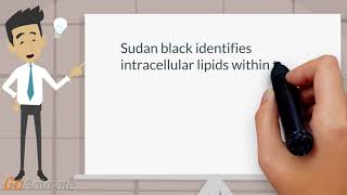 Sudan black stain in acute myelogenous leukemia [upl. by Kathrine]