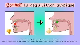 Corriger la déglutition atypique [upl. by Nnahtur30]