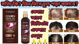 সত্যিই কিতিন দিনের চুল পড়া কমাবেfriyias onion hair oil review🥰best hair oilhairfall hair oil🥰 [upl. by Joh718]