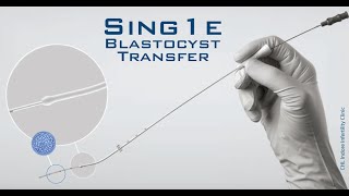 Embryo Transfer  Ultrasound Guided Embryo Transfer During ET  Embryo loading amp transferring [upl. by Robbins]