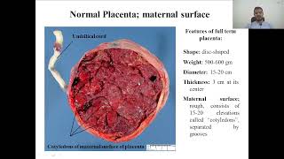 general embryology practical  placenta amp birth defect [upl. by Ahsatsana230]