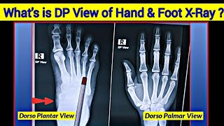 What is Dorsopalmar amp Dorsoplantar View  Hand Xray amp Foot Xray Positioning  UdayXray [upl. by Eleinad]