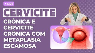 Cervicite crônica e cervicite crônica com metaplasia escamosa [upl. by Layman30]