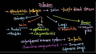 Pseudomonas aeruginosa infection [upl. by Sension748]