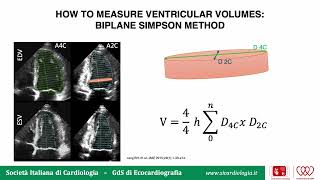 Valutazione ecocardiografica della frazione di eiezione del ventricolo sinistro [upl. by Nnylg]