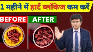 Foods to Unclog Your Arteries and Keep Your Heart Healthy I DR NAVIN AGRAWAL [upl. by Vaules]