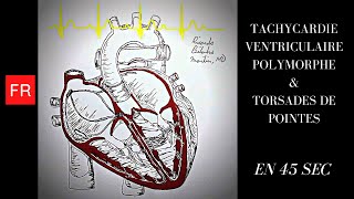 Arythmies animation cardiaque et ECG  Tachycardie Ventriculaire Polymorphe Shorts [upl. by Valer]