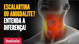 ESCOLAS FECHADAS POR BACTÉRIA ENTENDA O QUE É ESCARLATINA E A DIFERENÇA DA DOENÇA PARA AMIGDALITE [upl. by Ieppet]