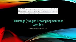 FIJI ImageJ Region Growing Segmentation Level Sets [upl. by Jarvey]