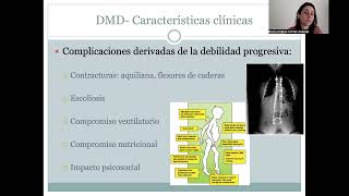 Sopnia Curso Actualización en Enfermedades Neuromusculares Capitulo 4 [upl. by Treblih217]