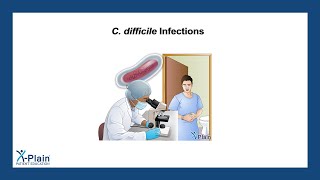 C difficile Infections [upl. by Iror]