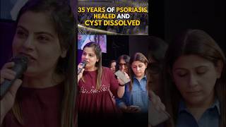 35 years of Psoriasis healed and cyst dissolved [upl. by Jareb]