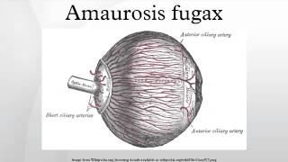 Amaurosis fugax [upl. by Munn]