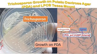 Trichosporon colony morphology on PDA and LPCB Mount Microscopy [upl. by Ranchod337]