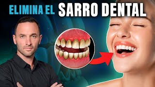 CÓMO QUITAR EL SARRO NATURALMENTE 🦷  Al final EL SECRETO para dientes BLANCOS Y SANOS [upl. by Vanderhoek25]