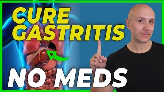 HOW to CURE GASTRITIS without medications  DR CARLOS [upl. by Cattier]