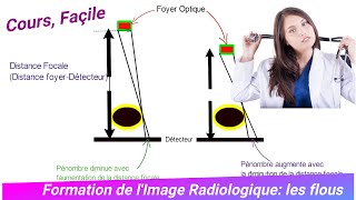 Formation dImage Radiologique  les Flous  Bases Physiques dImagerie Médicale [upl. by Ainsley]