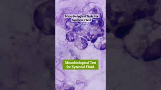 Microbiological Tests on Synovial Fluid medtech medtechstudent shortvideos synovialfluid fypシ゚ [upl. by Aicnatsnoc]