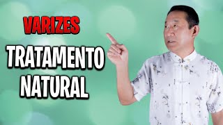 VARIZES Tratamento Caseiro  Peter Liu [upl. by Glover]