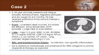 Detecting Vasculitis Before Its Too Late [upl. by Pell]